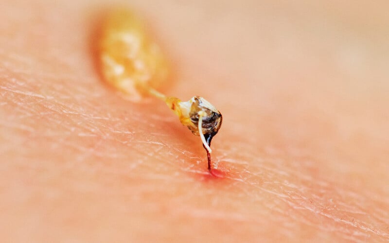 Close up of a bee stinger left in the skin. 